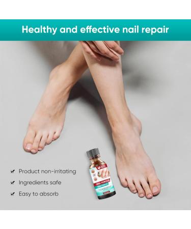 Nail Fungus Treatment for Toenail Fungal Nail Treatment Extra Strong Toe Nail Repair Kit for Thick Damaged Discolored Nails 30ML 30 ml (Pack of 1) - Buy Online on GoSupps.com