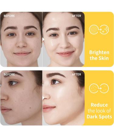 #OOTD Vitamin C Toner for Face Formula with Niacinamide Heartleaf and Squalane 8.45 FI Oz - Buy Online on GoSupps.com