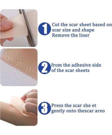 Silicone Scar Sheets - Restore Delicate Skin, Firm Adhesion, Cuttable for Hyperplastic Scar Removal - 4pcs 4x7.5cm - Buy Online on GoSupps.com