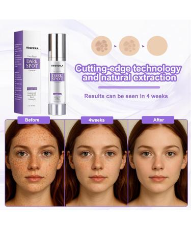 Dark Spot Remover For Face & Body Serum Rapid Remedy For Dark Spots Musely Dark Spot Remover Skin Bleaching Cream For Sun Spots Age Spots Dermatologist-Tested Brightening Retinol Serum (1.7 Fl Oz) - Buy Online on GoSupps.com