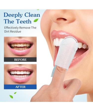 Beavorty Cleaning Wipes - 50 Pcs Disposable Oral Finger Toothbrush & Teeth Whitening Wipes for Deep Cleaning & Freshness - Buy Online on GoSupps.com