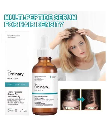 Original Ordinary Hair Growth Serum - Vegan Formula for Thinner Hair & Hair Loss | 60ml - For Men & Women - International Shipping - Buy Online on GoSupps.com