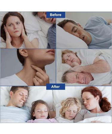 Mouth Tape for Sleeping: Gentle Snoring Aid, Improve Sleep Quality (120 PCS) - Buy Online on GoSupps.com