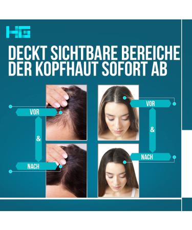 Hair Genetics Root Cover Up - Premium Medium Brown Hair Powder for Perfect Gray Hair Coverage - Buy Online on GoSupps.com