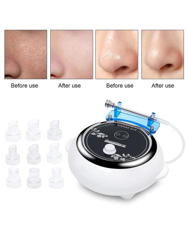 Aimengxi 3 in 1 Diamond Microdermabrasion Machine - Powerful Skin Care Device for Salon and Home Use - Buy Online on GoSupps.com