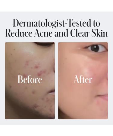 Geologie 2% Salicylic Acid Face Wash Bergamot + Juniper Scent | Facial Cleanser for Men & Women | Acne & Oil Control | Deep Cleansing & BHA Exfoliating Face Wash | 2-Pack 2.05 Fl Oz (Pack of 2) Scented - Buy Online on GoSupps.com