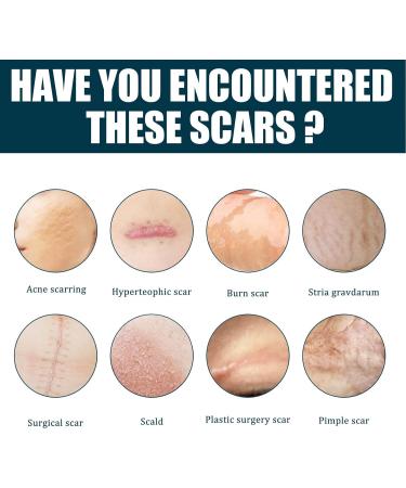 2Pcs 50ml Scar Gel with Allantoin & Vitamin E - Hydrate, Renew, Smoothing Stretch Marks Remover for Burn Surgery - Buy Online on GoSupps.com