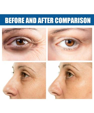 Eye Gels with Natural Marine Collagen & Hyaluronic Pearl Eye Masks for Puffy Eyes Eye Gel Pads for Puffy Eyes Anti Aging Eye Bags for Women Under Eye Patches Fine Lines Eye Bags Puffiness - Buy Online on GoSupps.com