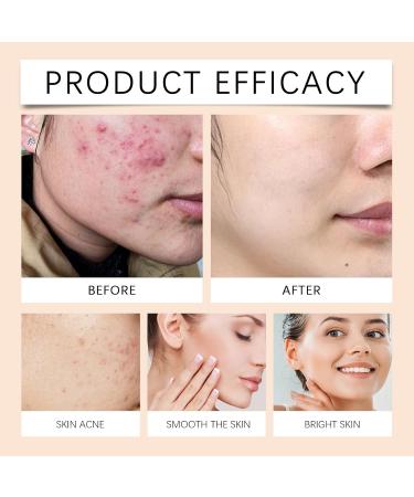 Facial Toner Spray - Hydrating Essence Water For Daily Use & Wet Compress Controls Oil Soothes Redness Refreshing Non-Greasy(2PCS) - Buy Online on GoSupps.com