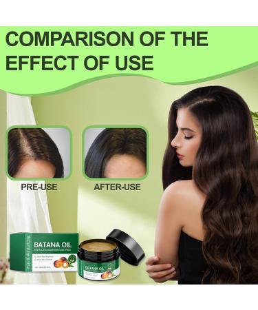 Benaewa Batana Oil for Hair Growth 100% Organic Raw Batana Oil Reduces Hair Loss for Women Men (100g) - Buy Online on GoSupps.com