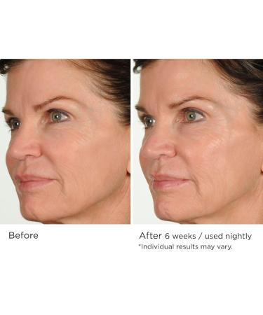 NassifMD Night Therapy Serum - Revitalize Skin Overnight | Shop Internationally - Buy Online on GoSupps.com