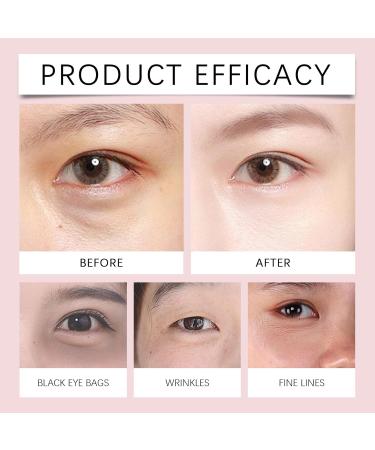 AuroraHyt Electric Massage Eye Cream Dark Circle Firm & Smooth Fine Lines Tired Eye Refreshment with Gentle Vibration for Anti-Wrinkle Firming Moisturizing 2 pcsk - Buy Online on GoSupps.com