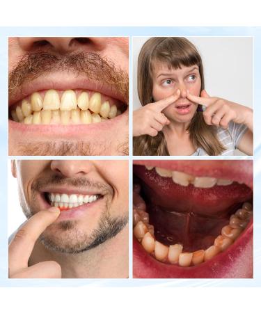Dguso Gum Therapy Gel - Deep Cleaning Tooth Stains & Tartar (3 Pieces + Toothbrush) | Best Gum Shield Therapy - Buy Online on GoSupps.com