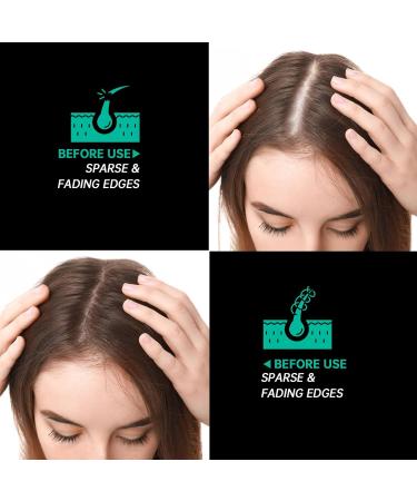 Pure Raw Batana Oil for Hair Growth - Unrefined Dr. Sebi Formula from Honduras | Boost Hair Thickness for Men & Women - Buy Online on GoSupps.com