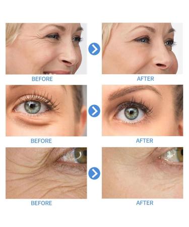 Retinol Serum for Face - Gentle Anti-Aging Formula with Hyaluronic Acid & Vitamin E | Hydrating 1 Fl Oz Anti-Wrinkle Solution - Buy Online on GoSupps.com