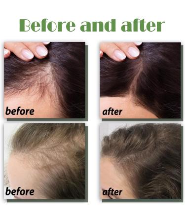 Serum Cheveux S rum de Croissance des Cheveux Avec Biotine Huile Pousse Cheveux pour Hommes et Femmes Traitement de Perte de Cheveux Hair Serum Pour Acc l rer la Croissance des Cheveux 120ml - Buy Online on GoSupps.com