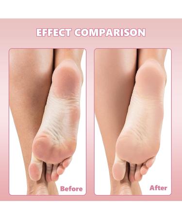 80 Pcs Stainless Steel Foot File Refills - Double Sided Pedicure Pads for Callus Removal - 180 Grit and 120 Grit Options - Buy Online on GoSupps.com