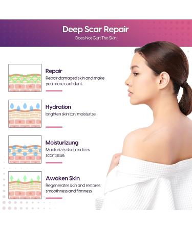 Morfone Silicone Scar Tape - Professional 1.6 x 150 Roll for Effective Scar Removal - C-Section, Surgery, Burn, Keloid, Acne - Waterproof - Buy Online on GoSupps.com