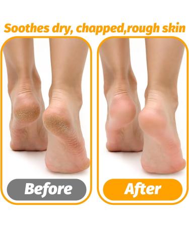 COMNICO 3 Pairs Moisturizing Socks Overnight Cotton Lotion Socks Soft Feet Moisturizer Spa & Pedicure Socks for Dry Feet Cracked Heels Men Women Foot Care Moisture Enhancing Socks One Size Fits Most - Buy Online on GoSupps.com