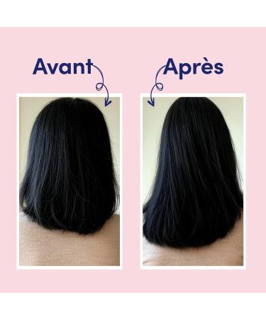MYRIAM K PARIS S rum Pousse Cheveux 140ml Scalp Stimule la Croissance & R duit la Chute Complexe Actif aux 9 Plantes & Procapil Pour Cheveux Clairsem s ou Affin s - Buy Online on GoSupps.com