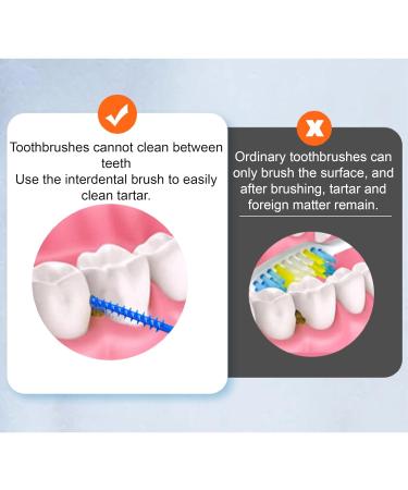 CRLLDPM 160 Soft Silicone Interdental Brushes - Gentle Tooth Cleaning for Optimal Oral Hygiene - Buy Online on GoSupps.com
