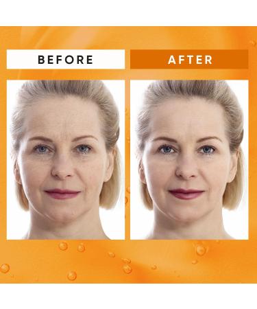 Super Vitamin C Serum for Women 60+: Hyaluronic Acid Anti-Aging Face Serum for Dark Spots & Wrinkles - Perfect for Mature Skin - Buy Online on GoSupps.com