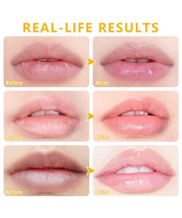 5 PCS Bee Balm Lip Balm Lip Mask Honey Pot Lip Mask Propolis Moisturizing Lip Balm Hydrating Prevention Dry and Cracked Lip Scrubs Exfoliator Lip Care (Strawberry&Watermelon&Honey&Apple Lime&Cherry) - Buy Online on GoSupps.com
