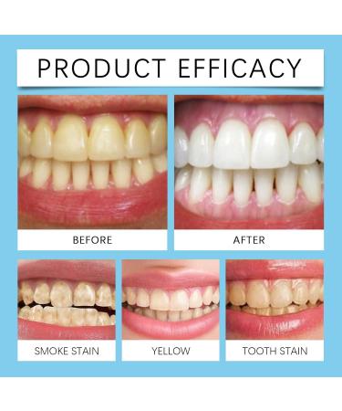 Oral Cleansing Mousse Toothpaste - Gentle Cleaning Stain/Tartar Removal Long-Lasting Fresh Breath Reduces Smoking Urge(3PCS) - Buy Online on GoSupps.com