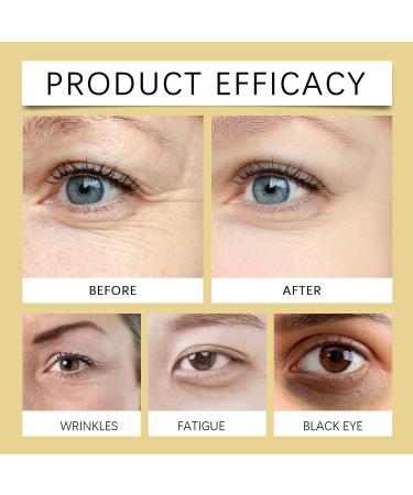  MagiSel Eye serum eye roller castor oil eye cream for dark circles and puffiness eye care anti-aging castor oil serum with 360 massage ball reduces - Buy Online on GoSupps.com