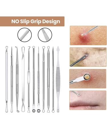 Dermated 16 PCS Blackhead Remover Pimple Popper Tool Kit | Stainless Acne Extraction Set for Face & Nose | Blemish & Whitehead Remover Tools in Metal Case - Buy Online on GoSupps.com