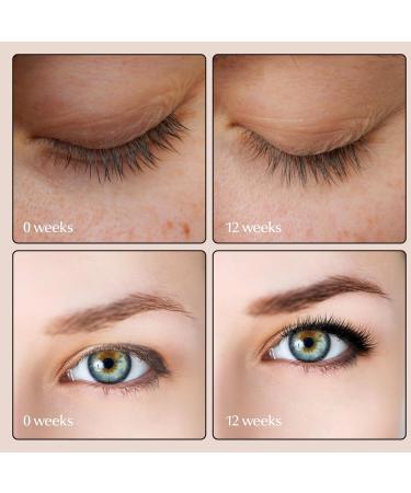 Lash Serum & Eyebrow Serum Kit Natural Formula Eyelash Growth Promotes Longer Thicker & Fuller Lashes & Brows Vegan Cruelty-Free For Sensitive Eyes (2 Pack 10ml) - Buy Online on GoSupps.com