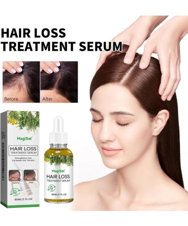 MagiForeign Hair growth serum rosemary oil accelerates hair growth with rosemary for hair growth oil massage the scalp to care for the hair prevents hair loss for men and women 60 ml - Buy Online on GoSupps.com