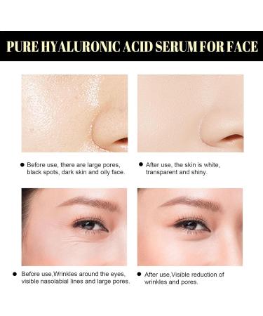  Stronrive 3 Facial Lifting Protein - Absorbable collagen protein thread for facial filling | Improves skin elasticity stretches the skinline - Buy Online on GoSupps.com