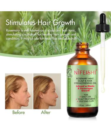 100% Natural Rosemary Oil for Hair Growth | 60ml Rosemary Oil for Scalp Aromatherapy & Massage - Buy Online on GoSupps.com