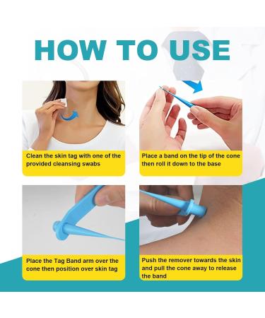 2-in-1 Skin Tag & Mole Remover Kit - Safe & Painless Removal for 2mm-8mm Sized Tags - Easy DIY at Home Green - Buy Online on GoSupps.com