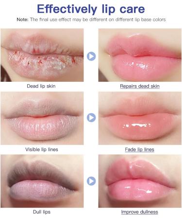 Lip Tube Moisturizer Lip Repair Cream Lip Repair Intensive Lip Repair Lip Balm Repair Hydrating Lip Balm Lip Balm Set Lip Cream for Dry Lips Lip Repair Ointment - Buy Online on GoSupps.com