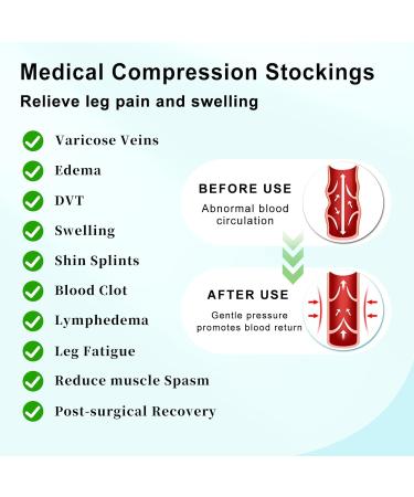 T.E.D. Anti-Embolism Compression Stockings - 15-20 mmHg Thigh High Support Socks for Men & Women - Post Surgery Relief for Swelling Varicose Veins Edema DVT - X-Large White - Buy Online on GoSupps.com