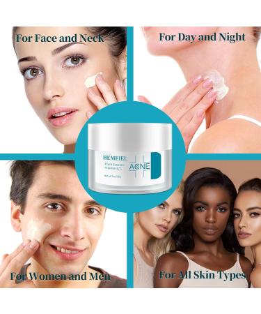 Herbal Acne Cream Anti Acne Face Cream Anti Acne Treatment with Centella And Licorice Extract Spot Cream For Blackheads And Acne Prone Skin Reduces Spot Size Face Moisturiser For All Skin Types - Buy Online on GoSupps.com