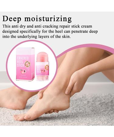  Yhsioaklo Anti-callus cream | 70 g Cream for very dry feet | Cream for cracked feet | Heel balm for dry and cracked feet | Repairing treatment moisturizing cream relief roller - Buy Online on GoSupps.com