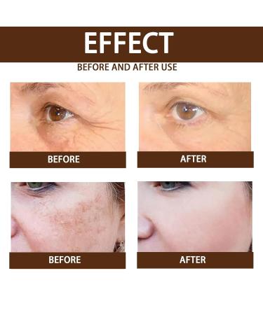 Turmeric Facial Serum - Natural Hydrating Face Serum for Dry Skin | 4 Bottles - Shop Internationally - Buy Online on GoSupps.com