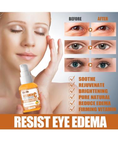 Vitamin C Eye Cream - Anti-Puffiness & Moisturizing Jasmine Ointment | 30ml - Buy Online on GoSupps.com