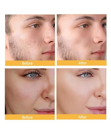 DEBAIY Moisturizer Cream Face Cream with 4% Niacinamide 3% Tocopherol Ceramides Boosts Skin Barrier for All Skin Types (3.53oz/100g) - Buy Online on GoSupps.com