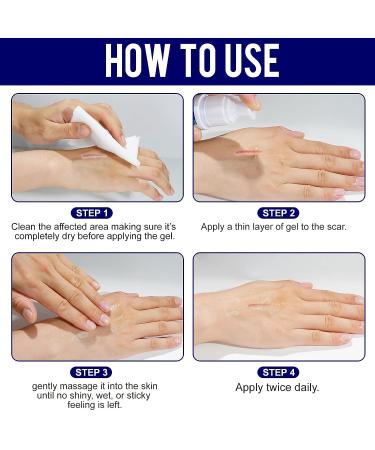 Scar Cream Gel with Retinol, Allantoin & Vitamin E - Advanced Scar Remover for C-Section, Stretch Marks, Acne, Surgery, Burns - 1.7 oz - Buy Online on GoSupps.com