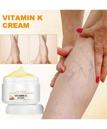 Miracle Cream for Varicose Veins Vitamin K Formula Varicose Relief Cream Vein Repair Cream Relieves Leg Fatigue Moisturizes and Promotes Blood Circulation - Buy Online on GoSupps.com