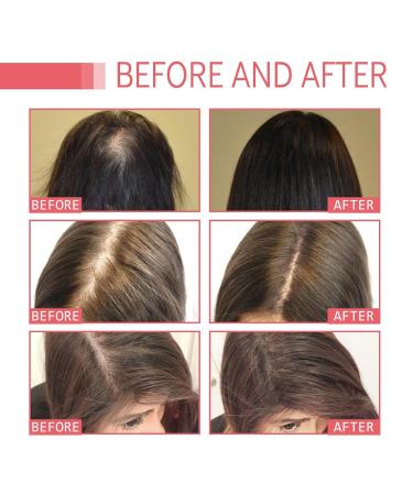 Rosemary Hair Oil - Natural Pure Essential Oil for Hair Growth & Skin Care | Cypreason - Buy Online on GoSupps.com