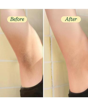 BareSoul Glowy Body Peel - 25% AHA Exfoliating Body Scrub for Women - Improves Uneven Texture on Underarms Elbows Knees & Buttocks - Gentle Body Skin Care Products - 1.76 Oz | 50g - Buy Online on GoSupps.com