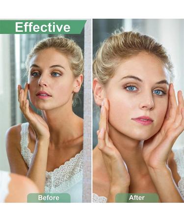 Portable Mild Hair Removal: Non-Irritating for Armpits Hands & Feet | Smooth & Gentle Solution - Buy Online on GoSupps.com