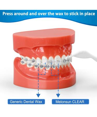 Braces Wax 10 Pack - Food-Grade Dental Wax Strips with Applicator Tool - Unscented/Mint + Aloe Vera + Vitamin E - Stick Better - Includes Storage Box - 350+ Dots - Separate Cases - Buy Online on GoSupps.com