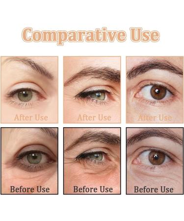 AYVRUOP AYVROUP Perfection Eye Tightener instant and temporary firming cream for the eyes moisturizing firming cream for the eyes for most skin types 20 g - Buy Online on GoSupps.com