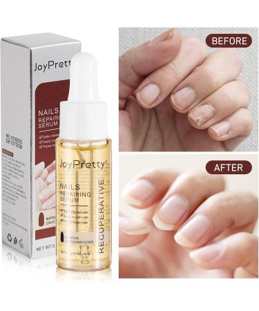 minkissy Nail Repair Serum Nail Repair Liquid for Toenail and Fingernail Nail Repair Solution for Thick Cracked Discolored Nails Restore Healthy Nails - Buy Online on GoSupps.com